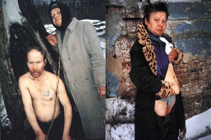 Из серии «Case History» (1997—1999)