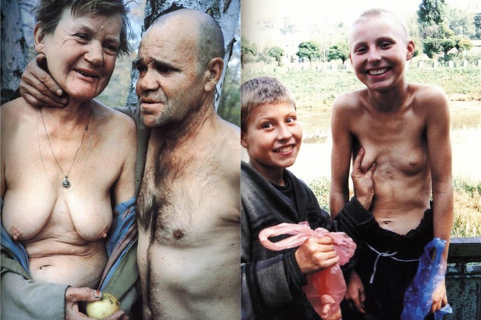 Из серии «Case History» (1997—1999)