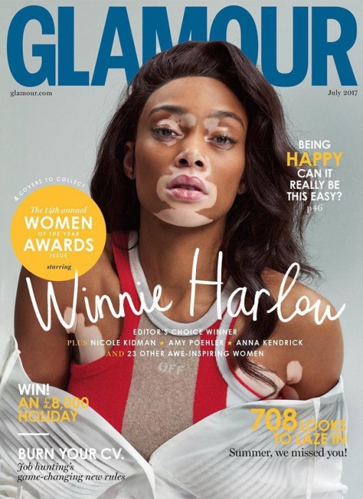 Модель с витилиго Винни Харлоу на обложке британского Glamour, 2017 год