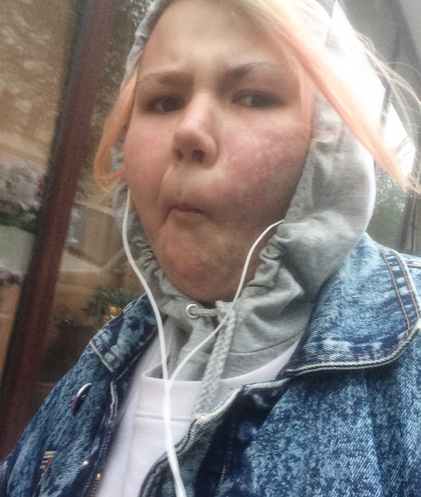 С этой фотографии @miliyollie начался массовый флешмоб #твоелицовсегданорма