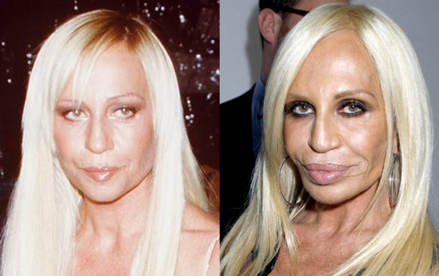 Фото до и после пластических Фото до и после пластических