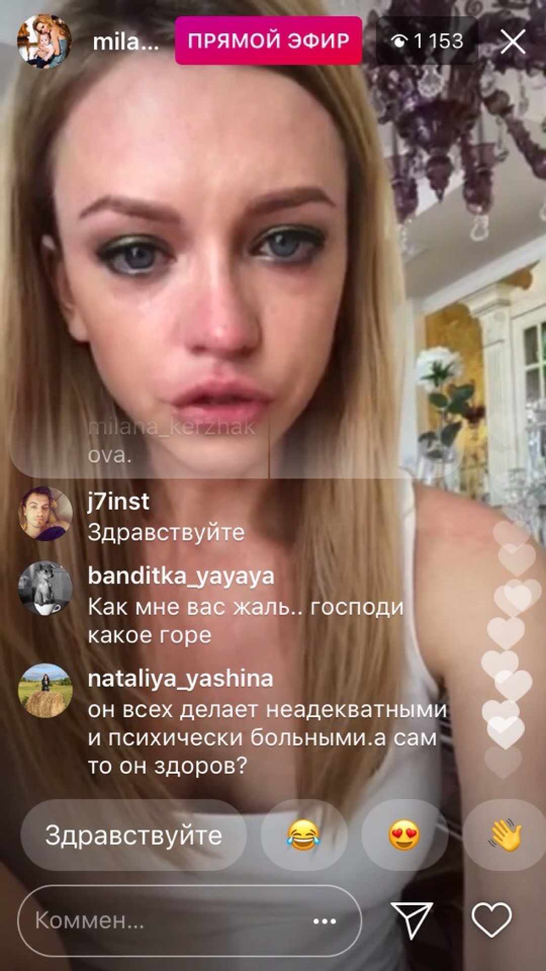 милана тюльпанова до пластики