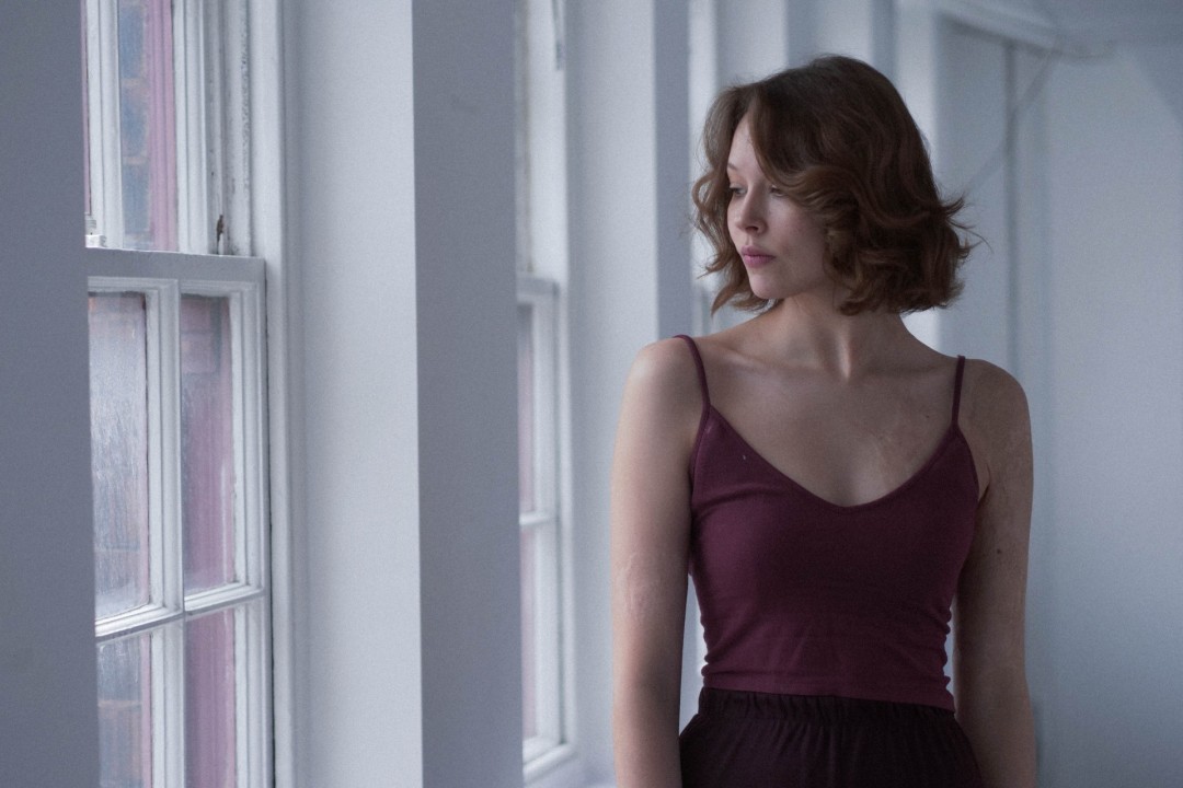 Анастасия Шилович — амбассадор #ProjectTheSkin. Фото: Peter Simison