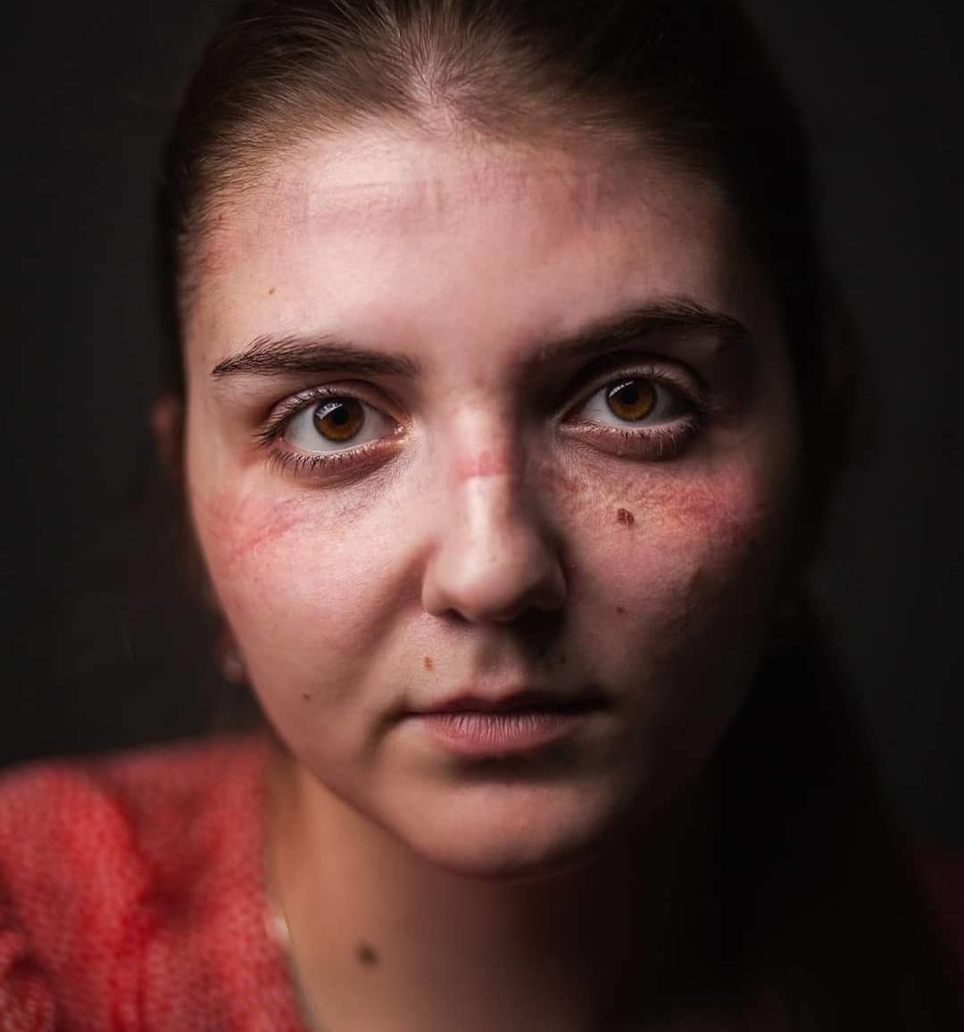 Виолетта Мальцева, медсестра терапевтического отделения клиники БГМУ. Фото из проекта «Красная зона».