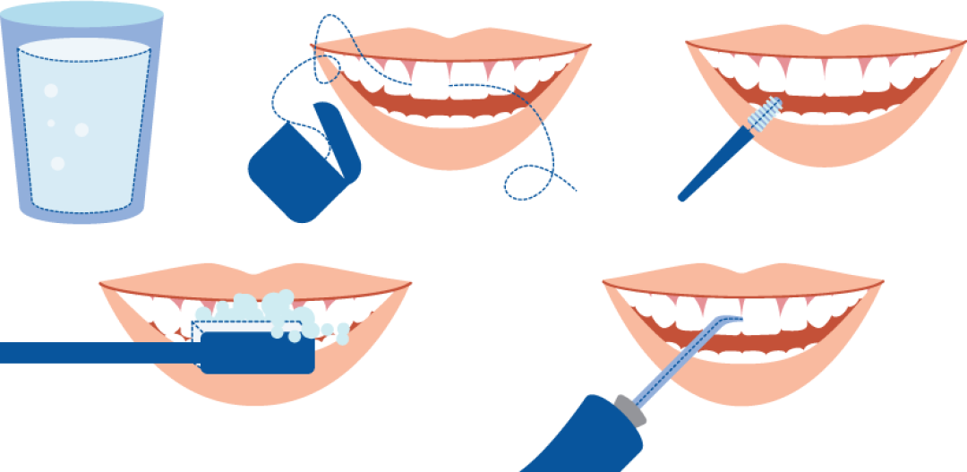 Как почистить зубы без. Алгоритм чистки зубов. Схема чистки зубов. Алгоритм чистки зубов для детей. Схема чистки зубов для детей.