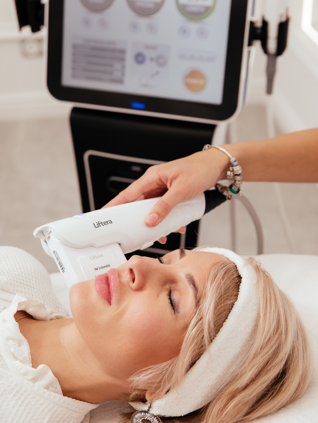 SMAS-лифтинг (безоперационная подтяжка лица на аппарате Liftera-A)