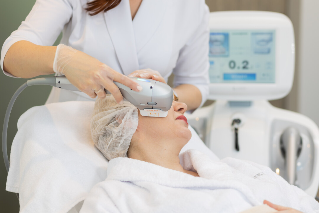 SMAS-лифтинг Ultraformer III по лицу