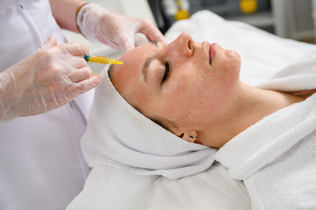 Плазмолифтинг