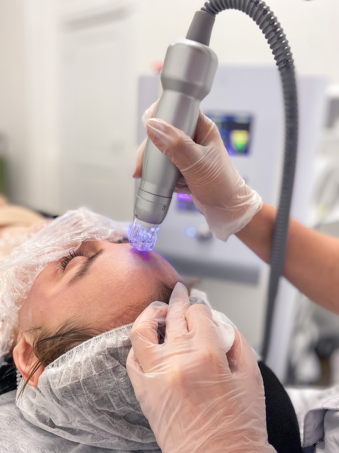 Микроигольчатый RF-лифтинг Scarlet S