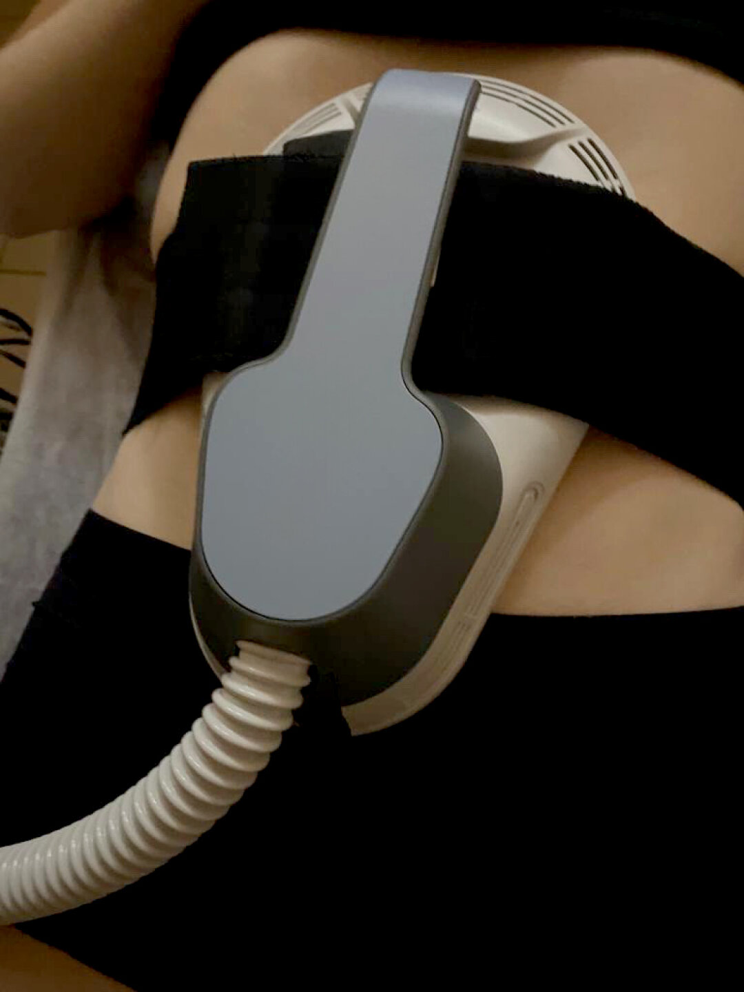 Процедура EMSculpt укрепляет пресс, ягодицы, бедра, повышает мышечный тонус и создает четкие контуры