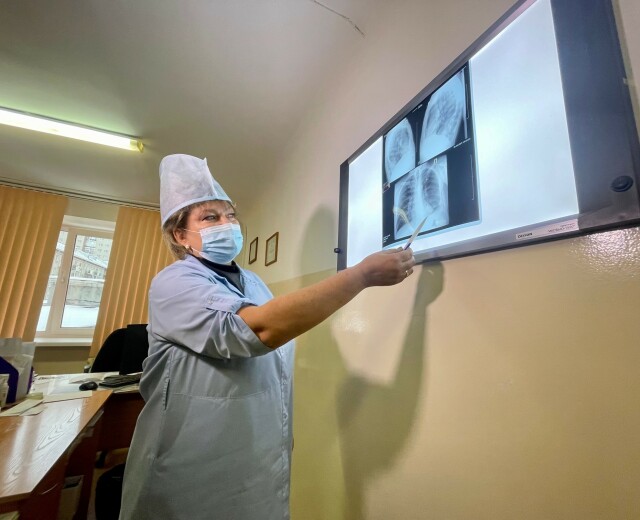 Уровень заболеваемости туберкулезом в Новосибирской области впервые стал ниже, чем в целом по Сибири